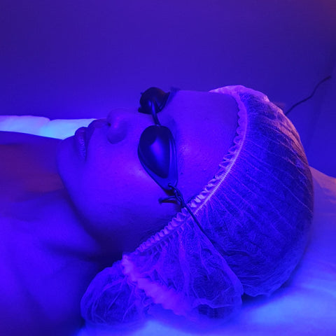 12 LED Light Therapy Facials + 3 Free Peels